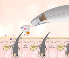 Electric Blackhead Remover
